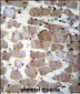 CTSK Antibody (Center E112)